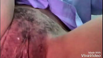 Fotos do sexo do bb menino na ultrassom