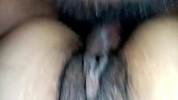 Sexo oral assou a vagina e queimou